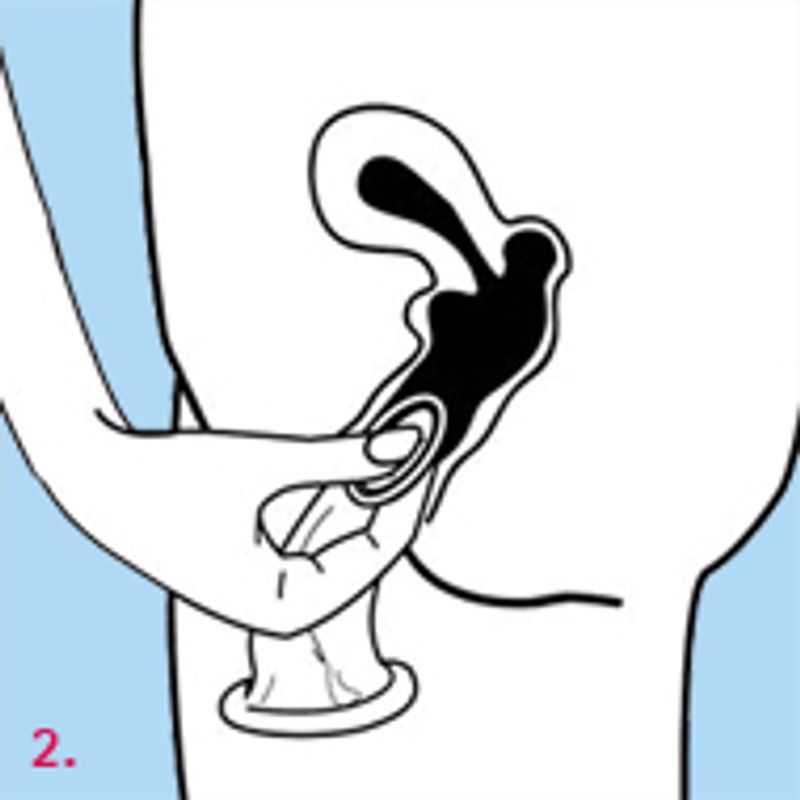 Illustration showing how to use female condoms for contraception effectively.