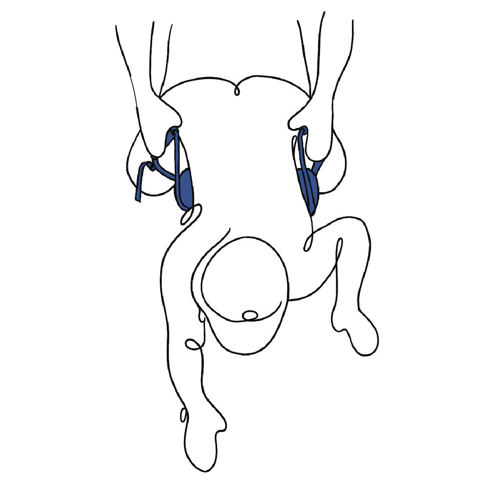 Illustration of the Pivot Deluxe Doggie Strap - Position Harness Strap showing how to use the padded handles for support.